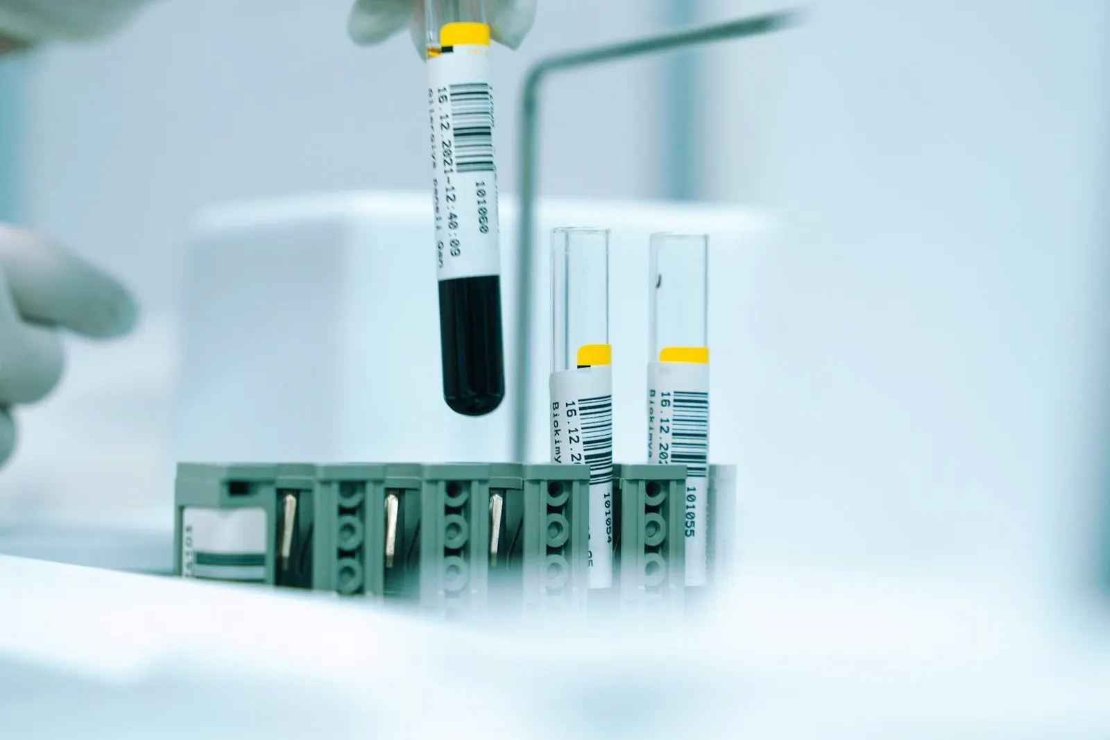Muestras de sangre en un laboratorio